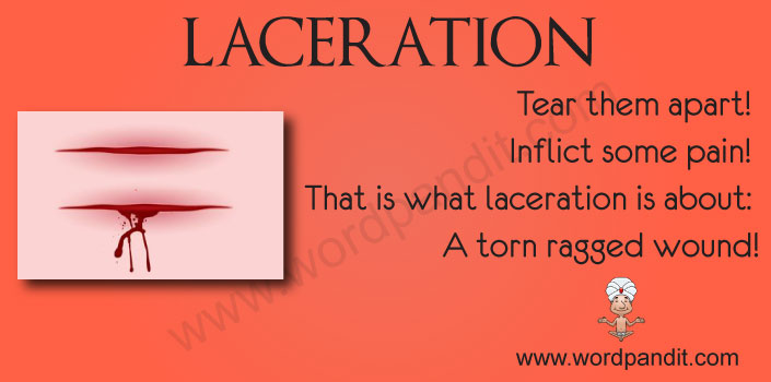 picture vocabulary for laceration